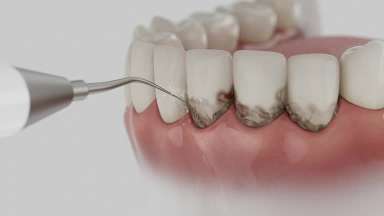 Reliable Tooth Extraction contractor in Saline County County, NE by Dentist Open Now